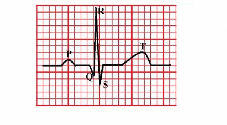 Kalp frekansları-p-q-t 